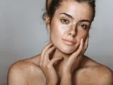 Una mujer con manchas en la piel