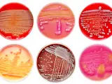 Cultivos de bacterias en placas petri