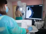 Imagen de una señora realizándose una mamografía para la detección precoz del cáncer de mama.