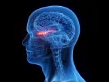 La neuromielitis óptica afecta principalmente al nervio óptico, pero puede dañar otras muchas zonas del cuerpo.