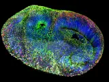 Un organoide cerebral con mutaciones celulares individuales en genes relacionados con el autismo (las distintas mutaciones vienen indicadas por colores diferentes). La mitad superior es una imagen de microscopía, y la inferior un mosaico creado para representar las distintas mutaciones.