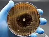 Imagen de un cultivo de bacterias en el que se ha llevado a cabo una prueba de resistencia a los antibióticos.