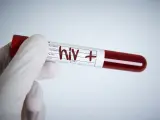 Un vial de sangre con una marca de VIH positivo.