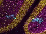 Las células derivadas de la médula ósea suponen una terapia potencial para tratar enfermedades neurodegenerativas. La imagen muestra una inmunofluorescencia de una sección de cerebelo con dos células de Purkinje fusionadas que expresan GFP en color cian.