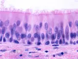 Células epiteliales