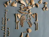 Restos de un niño de la Prehistoria con síndrome de Down enterrado en Alto de la Cruz, Navarra.