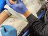 La extracción del dedo de la bebé terminó en el hospital.