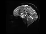 Imagen de perfil de uno de los cerebros escaneados por la máquina de resonancia magnética más potente del mundo.