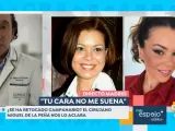 El cirujano Miguel de la Peña revela los retoques estéticos de María José Campanario.