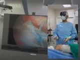 Médico operando con las Apple Vision Pro