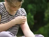 Niña rascándose la picadura de un mosquito