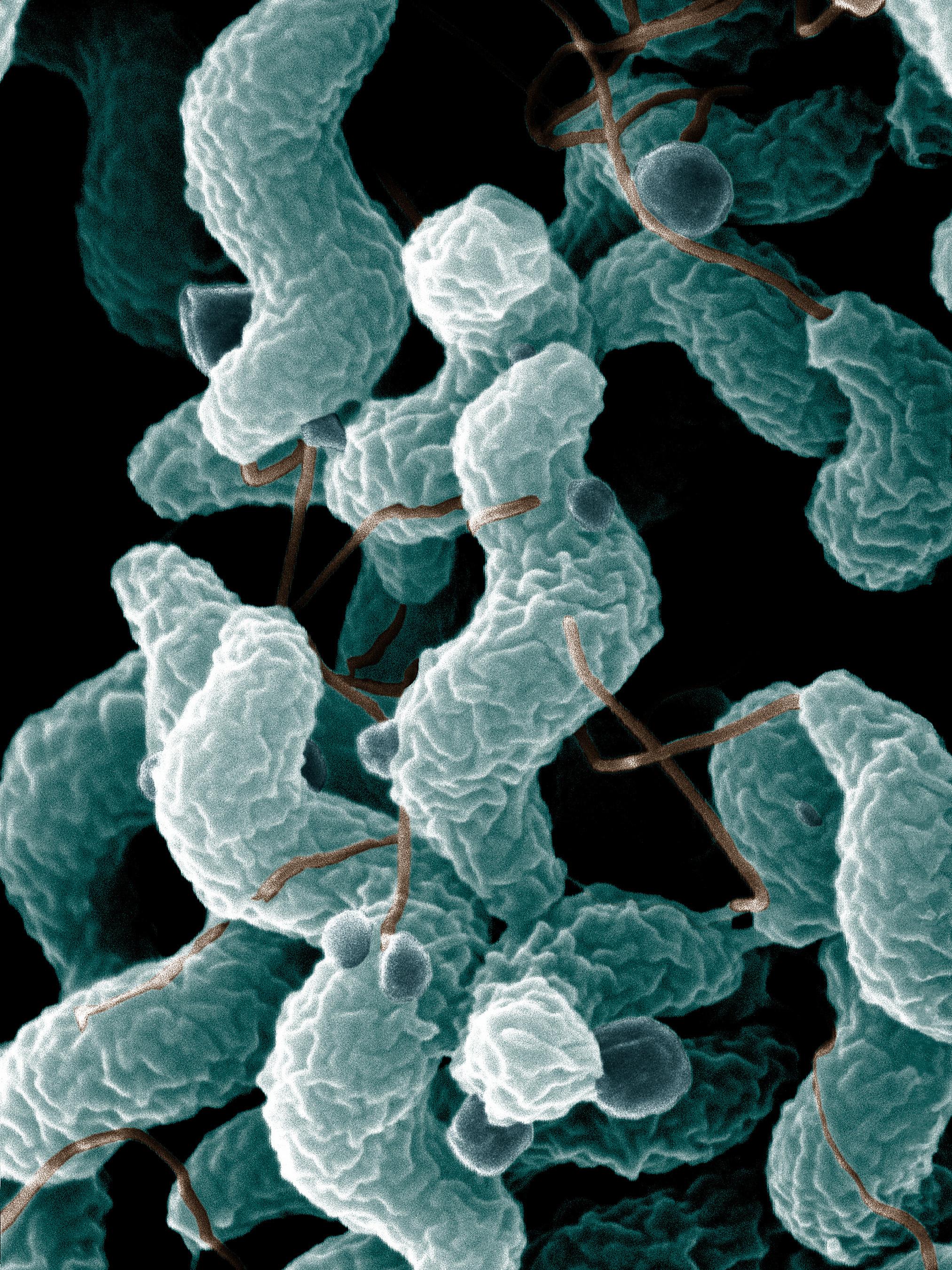 Bacterias del género Campylobacter.