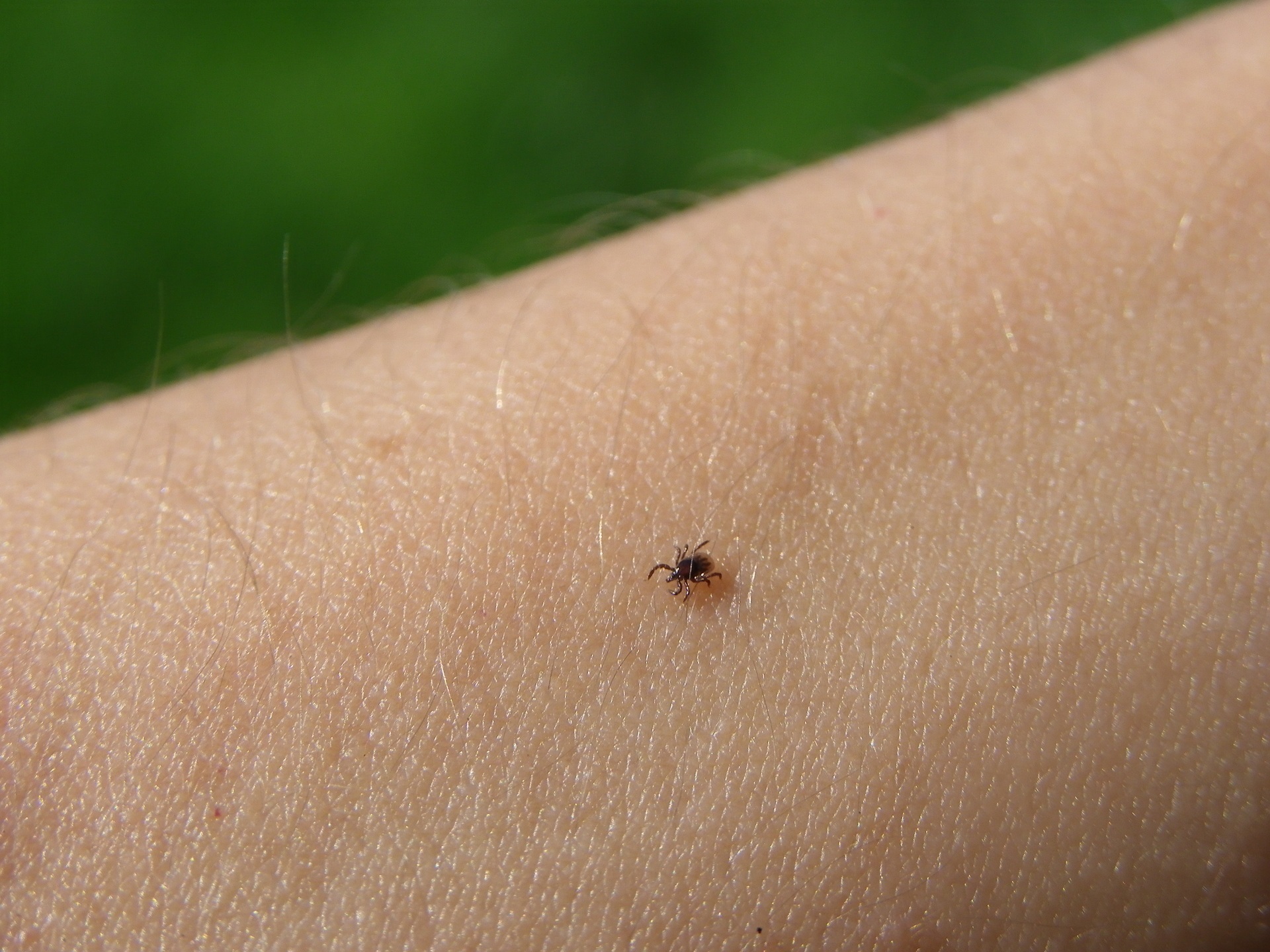 A tick on a person's skin, in a file image.