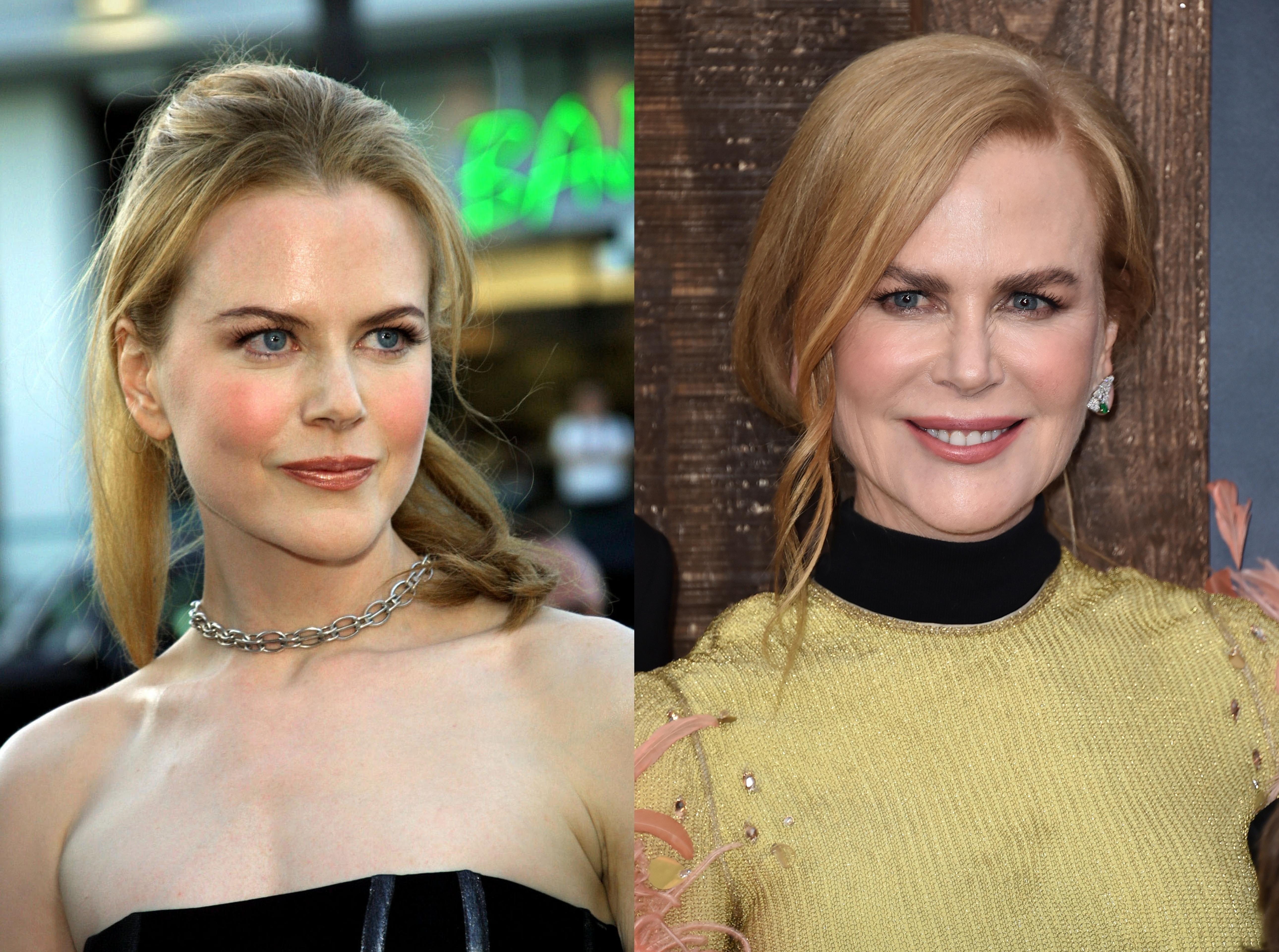 Nicole Kidman in 2001 and in 2022