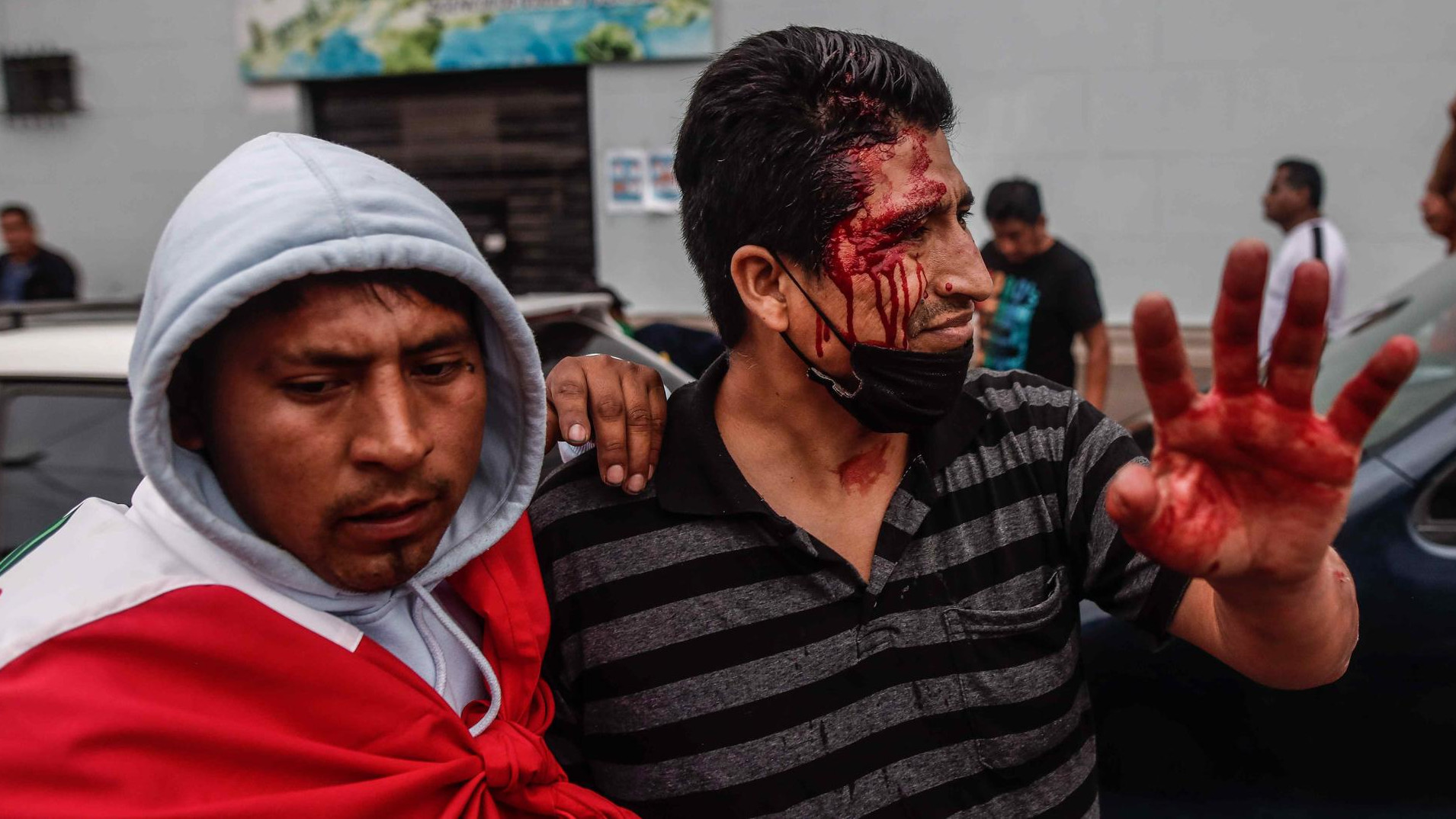 Un hombre herido, tras los enfrentamientos registrados entre simpatizantes y detractores de Pedro Castillo frente a la Prefectura de la Policía de Lima, donde permanece detenido el expresidente peruano.