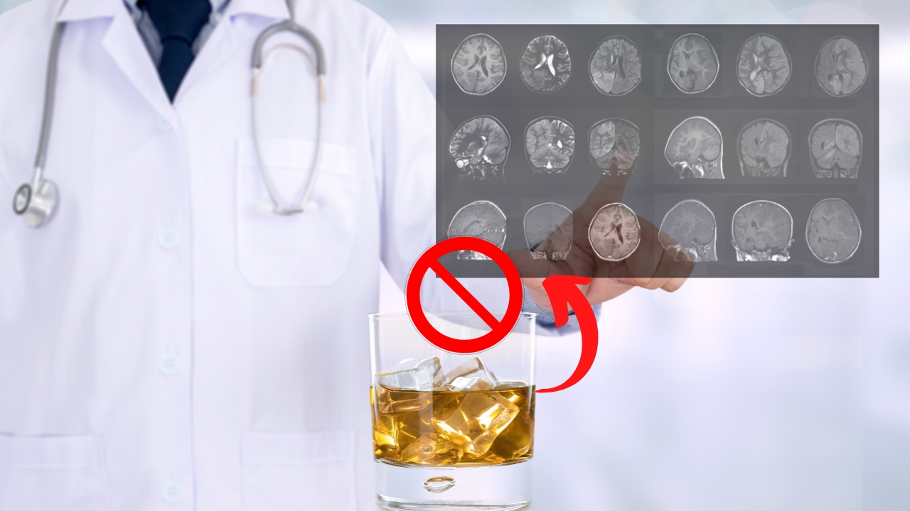 Moderate Alcohol Consumption Linked to Faster Alzheimer's Progression
